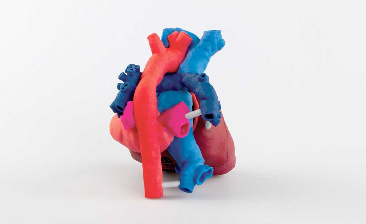 3D Systems' Medical Workflow Enables OpHeart's Mission